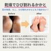 Kounbal Heel Cream (Yellow) + Heel Socks Set for Cracked Heel Care and Callus Care. Korean-made, Moisturizing, Antibacterial, Antioxidant, Heel Protec