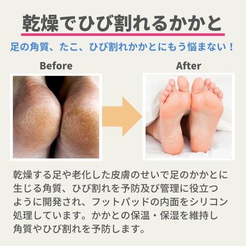 Kounbal Heel Cream (Yellow) + Heel Socks Set for Cracked Heel Care and Callus Care. Korean-made, Moisturizing, Antibacterial, Antioxidant, Heel Protec
