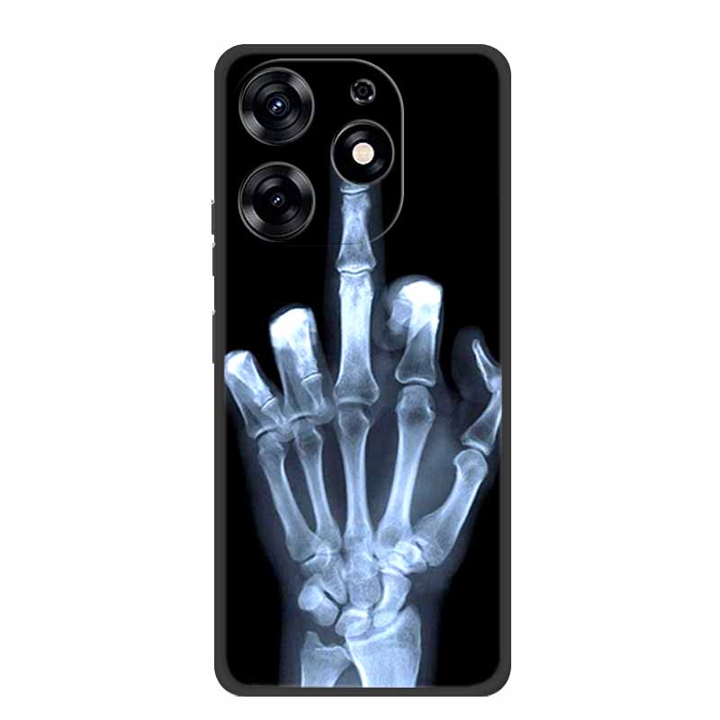 For Tecno Spark 20 Pro Case Spark20 Pro Coque Black Silicone Soft Back Cover For Tecno Spark 10 Pro Ki7 Phone Case Spark10 Pro