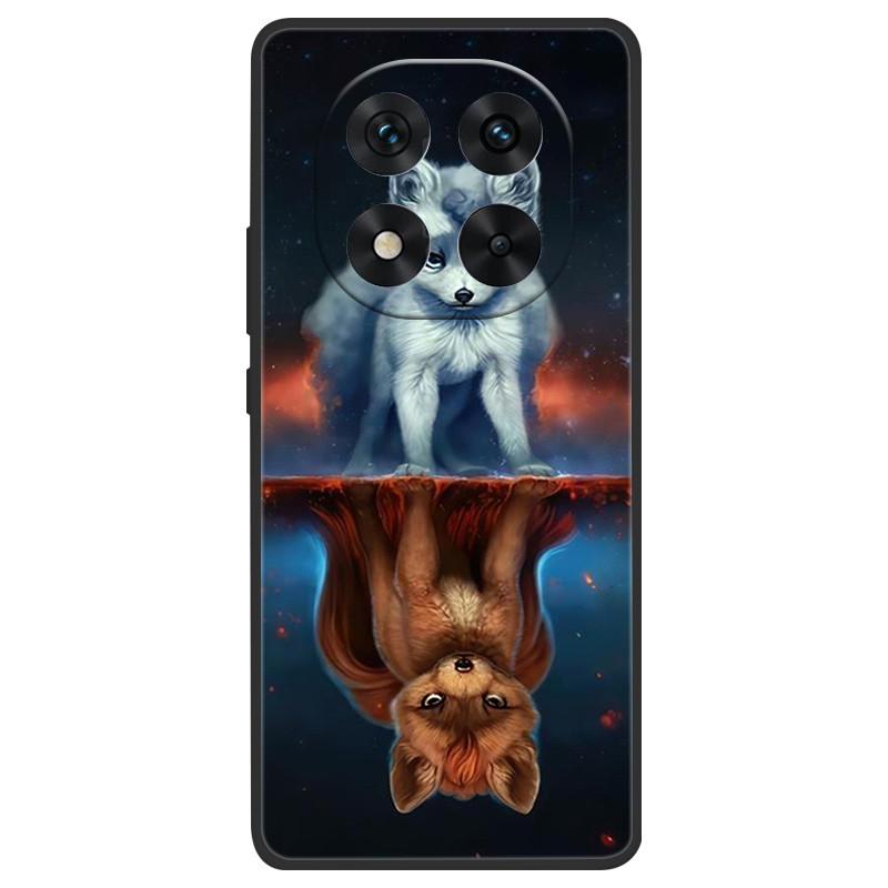 

For Redmi Note 14 Pro Plus Case Silicone Luxury Space Soft Bumper for Xiaomi Redmi Note 14 Pro 4G 5G 2025 Phone Cover TPU Funda Note 14 Pro Plus