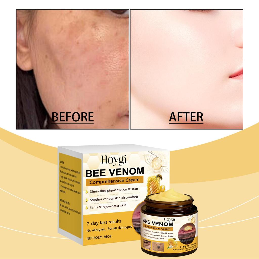 Cremă de îngrijire a pielii cu venin de albine - Hidratantă, Hidratantă, Hrănire delicată pentru o îngrijire facială zilnică moale și tandră