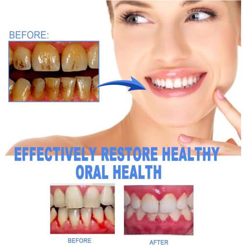 Gum Shield Therapy Gel, Teeth Whitening Essence Pen, Teeth Whitening Gum Instant Treatment Gel, Gum Shield Therapy Gel, Teeth Whitening Essence Pen, T