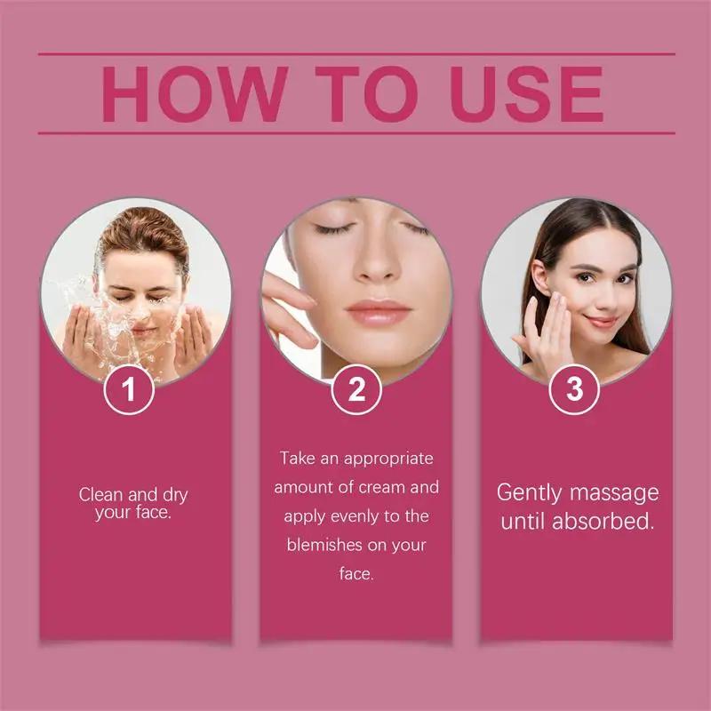 Powerful Spot-Removing Whiten Cream Brighten Skin Fast Eliminates Melanin Pigmentation Melasma Dark Spots