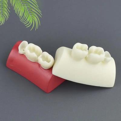 1ks model ústní výplně Cvičení model zubní inleje Cvičení blokové výplně Typodont Pryskyřice Materiály pro výuku zubního lékařství Stud
