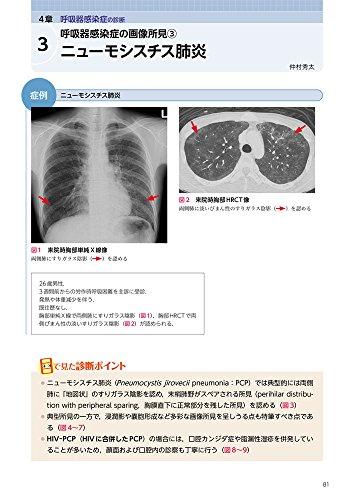 Visual Infectious Diseases: How Much Can You Diagnose by Appearance? An Atlas of Infectious Disease Images