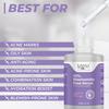 Lavaya 10% Niacinamid Gesichtsserum mit Zink-PCA | Reduziert Aknenarben | Bekämpft Akne | Kontrolliert die Talgproduktion | Mindert Pigmentflecken | 30 ml
