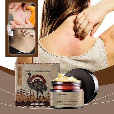 Psoriatic Skin Relieving Cream Cleansing Relieving Skin Redness Discomfort Smoothing Skin Skin Care