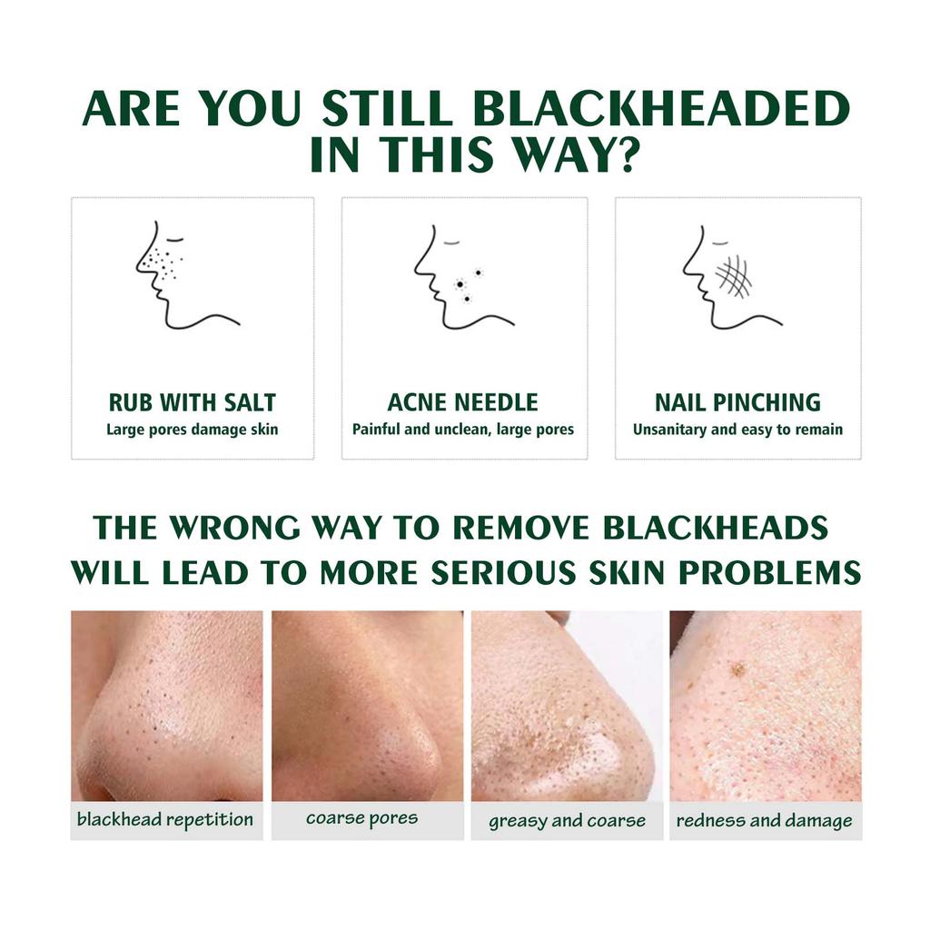 EELHOE Blackhead Removal Nose Strips: Deeply Cleanses Pores, Gently Removes Blackheads and Whiteheads, Oil-controlling Mud Mask.