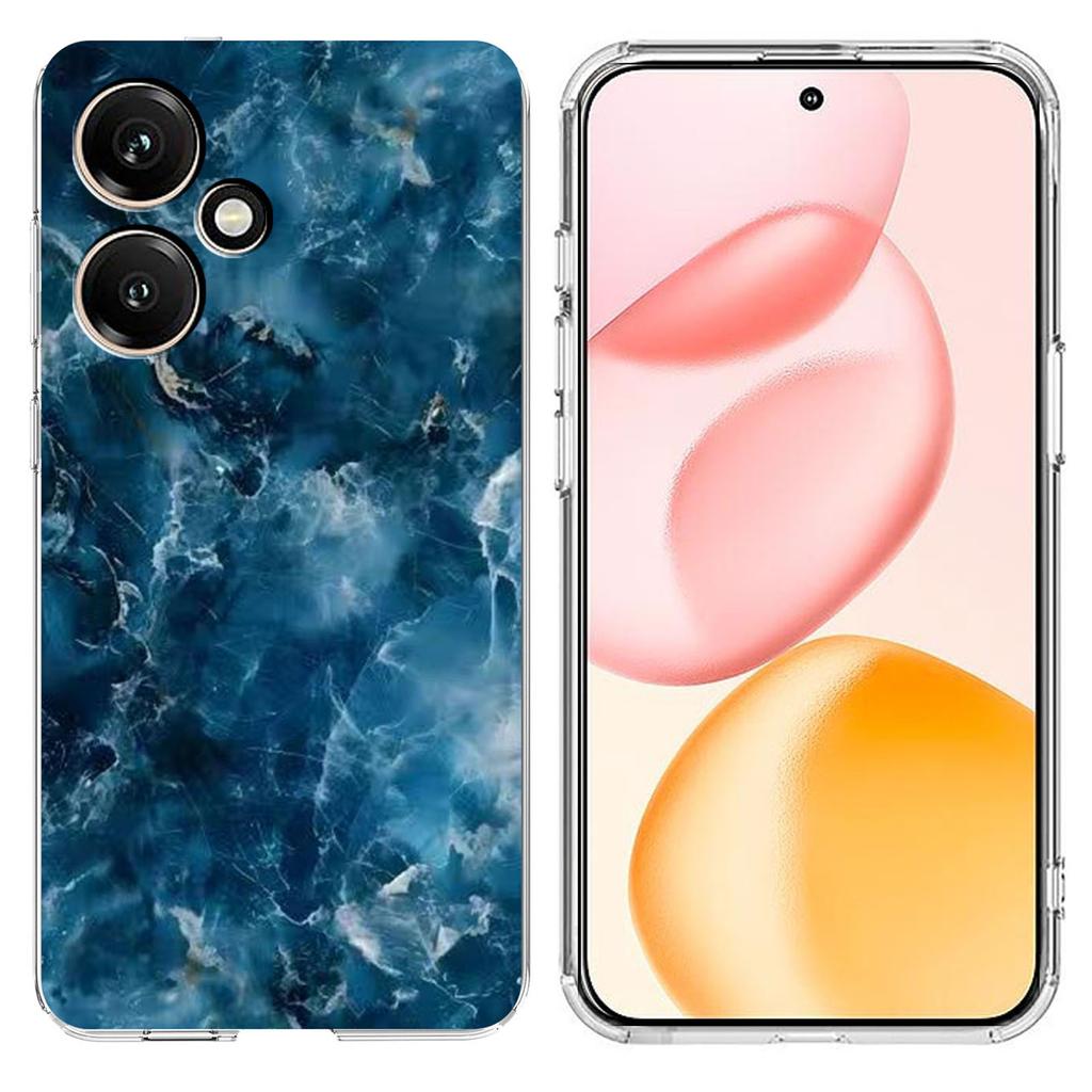 For Honor 400 5G (Global) Case Marble Pattern Printing Soft TPU Phone Cover