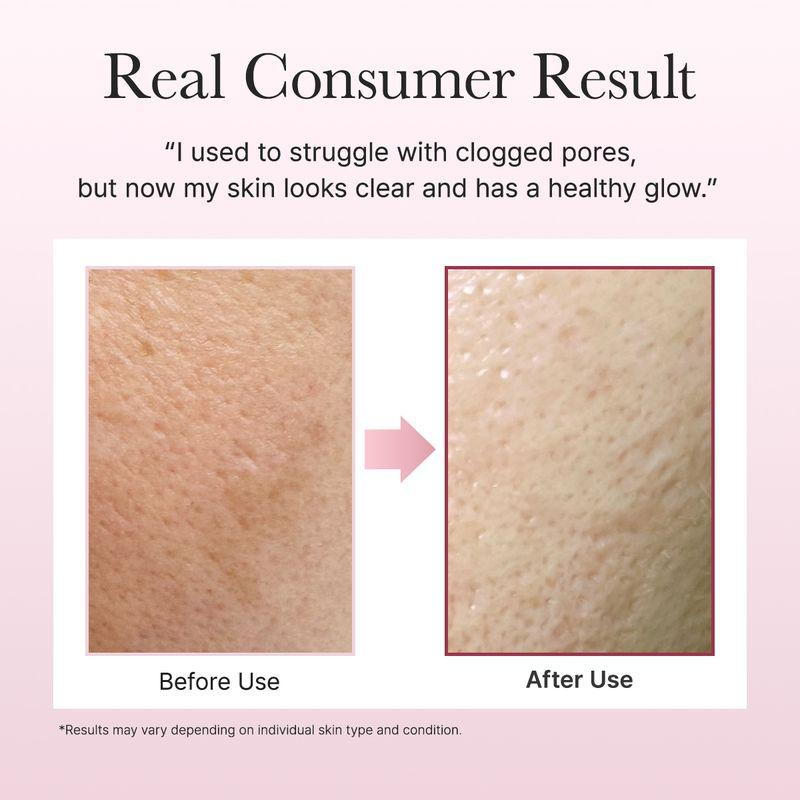 arencia *renovar* Limpador Mochi de Arroz e Rosa Mosqueta Fresco 120g