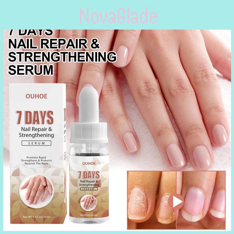 Revitalizing Ouhoe 7 Day Nail Repair Essence For Healthy Strong Nails And Toenails