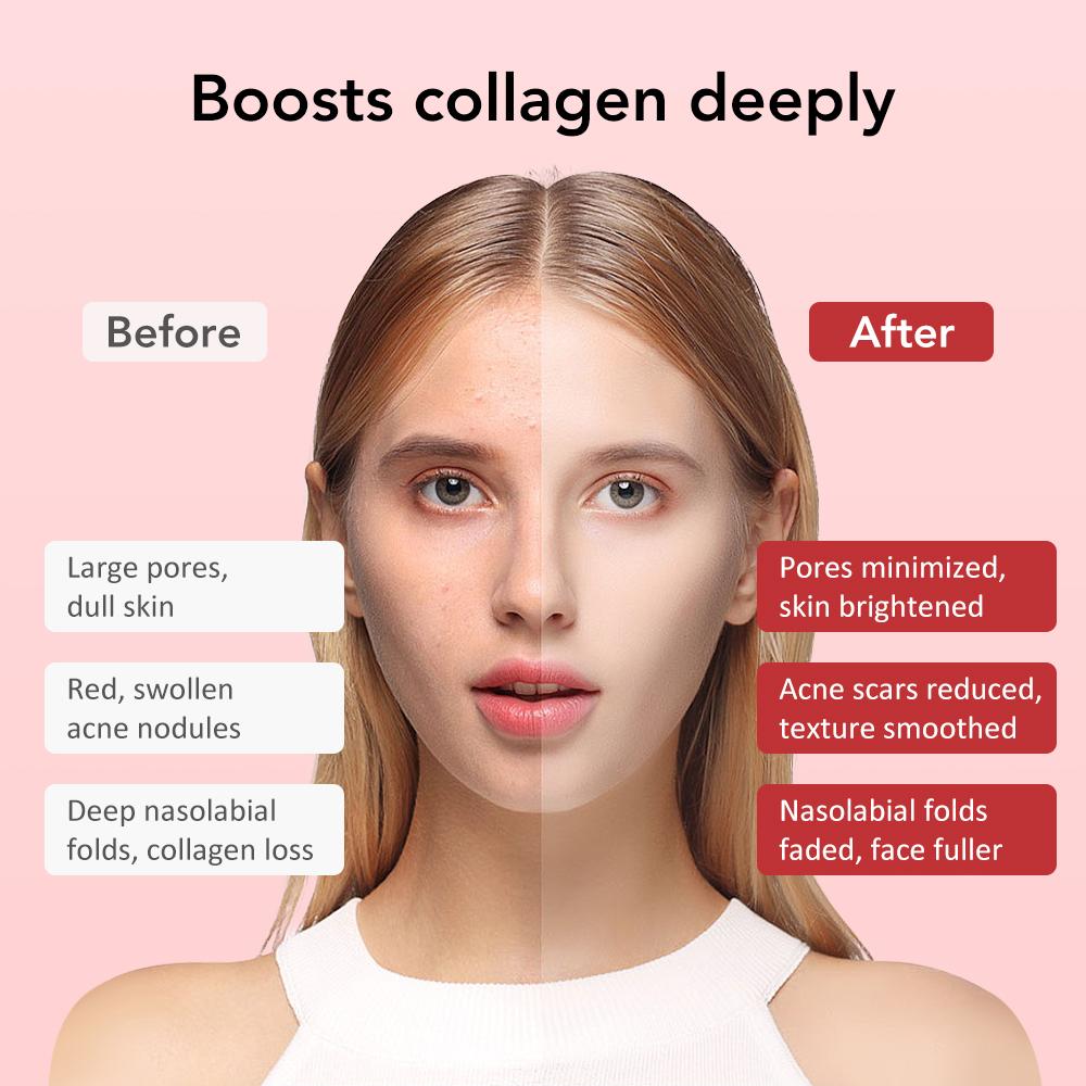 7 in 1 RF EMS Facial Massager Skin Care Tools Face Lift Multifunction Firm Device Skin Rejuvenation Wrinkle Removal Face Beauty