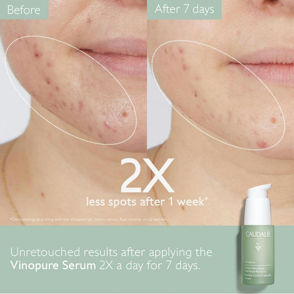 Caudalie Vinopure Blemish Control Salicylic Acid Serum 30ml