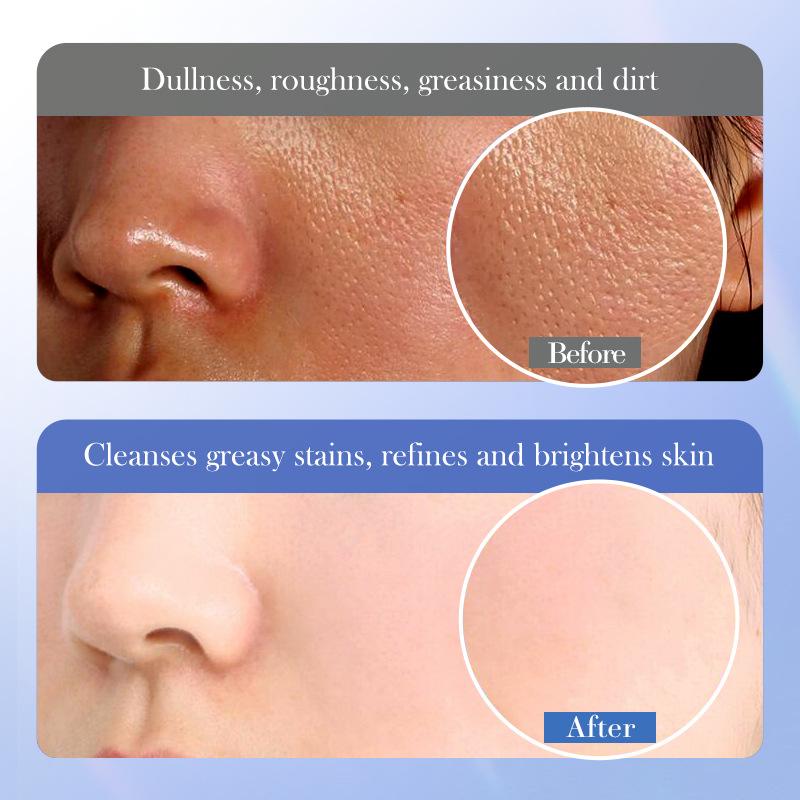 BIOAOUA Cleansing Wash Ceramide Salicylic Acid Cleanser