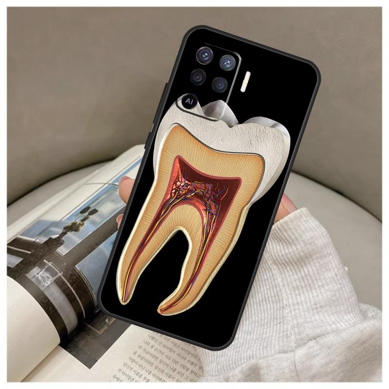 Human Tooth Anatomy Case For Oppo A74 A94 A54 A18 A38 A58 A78 A98 A80 A60 A40 A96 A76 A16 A15 A17 A57 A77 A5 Pro