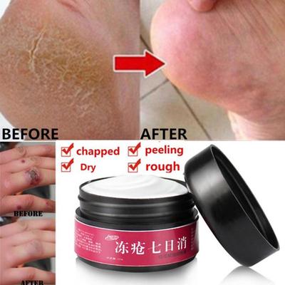 30g Chinese Foot Crack Cream Anti Dry Moisturizing Heel Hand Care