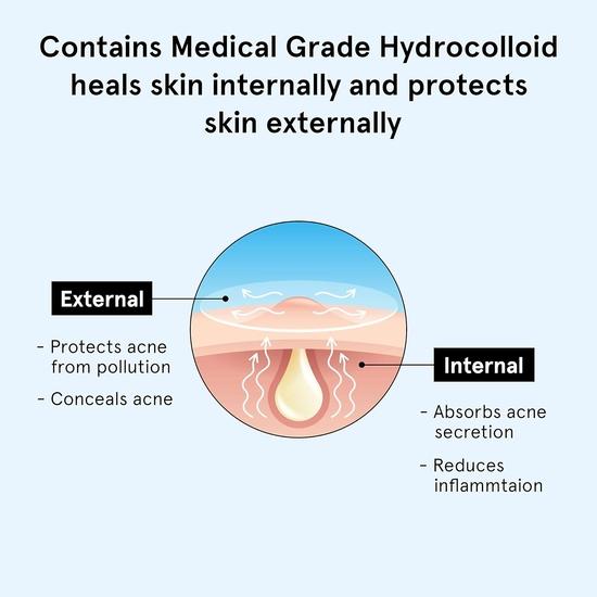 Be Bodywise Akne Pickel Patch für Frauen(24 Punkte | 3 Größen) & 2% Salicylsäure Gesichtswaschgel für Frauen 100ml | Reinigt Ihre Haut porentief und beugt Akne vor