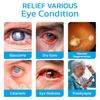 Ximonth Eye Massage Roller Relieves Eye Discomfort, Blurriness, And Moisturizes The Eye Area Around The Eyes