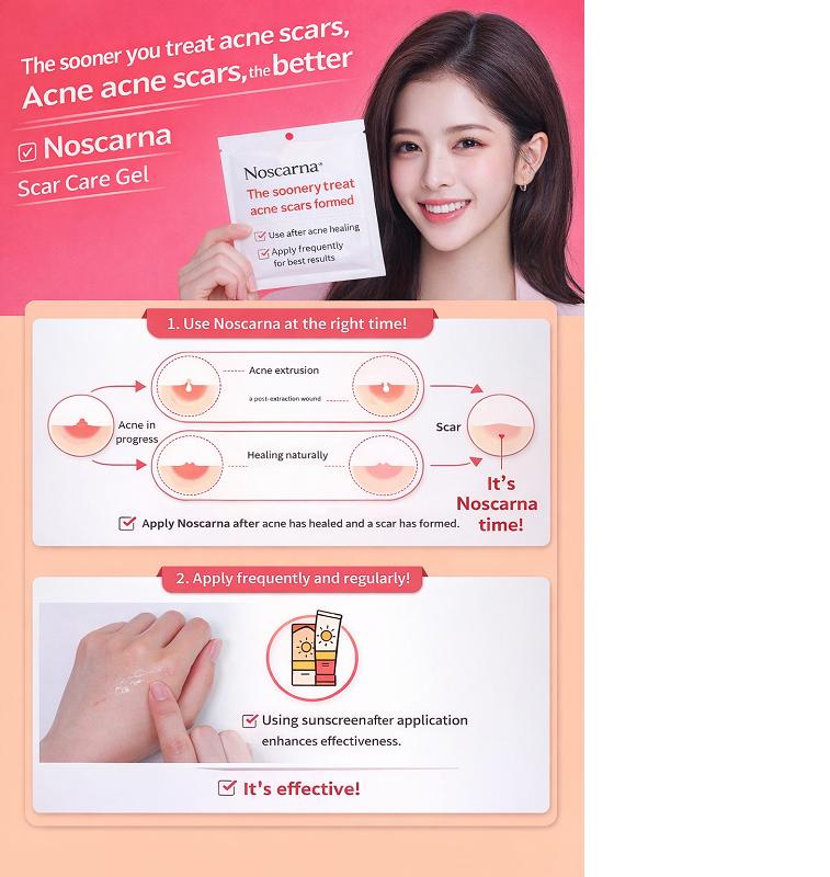 Noscarna Scar Care Gel 20g Triple Repair Healing Acne Scar K-Beauty Skin Repair