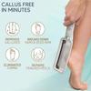 Professional Foot Scrubber Dead Skin Remover Kit - Foot File & Callus Gel Feet Scrubber Scraper Set