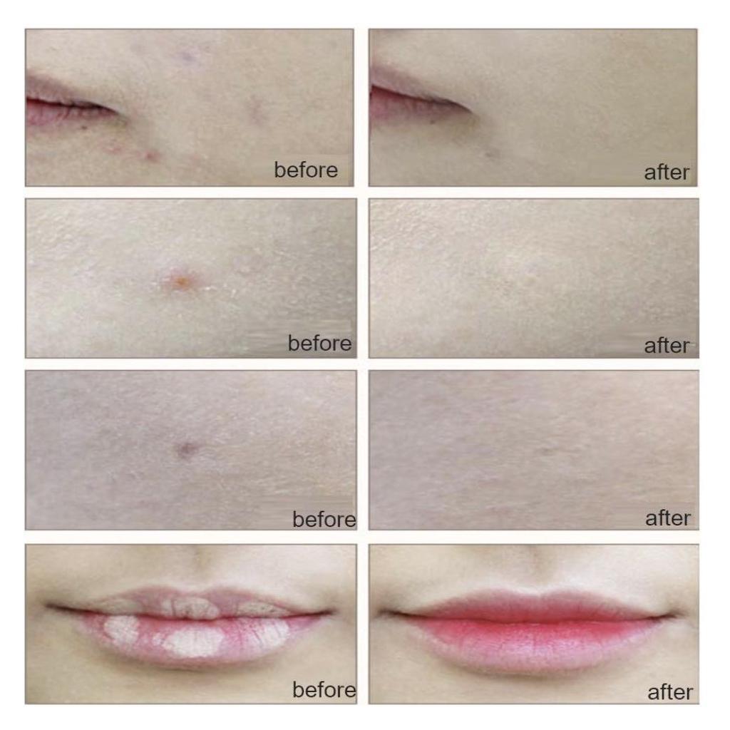 SIDMOOL Dr. Troub Blemish Spot Concealer 5g