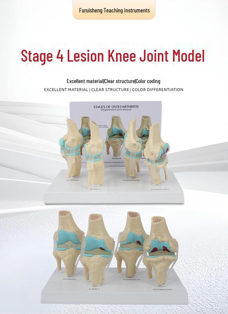 4-Stage Human Knee Evolution Model for Teaching and Display