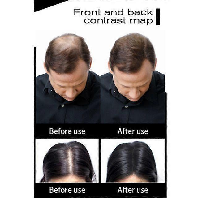 Black Hair Loss Building Fiber Powder Hair Thickening Powder Keratin Hair Fiber Wig Extension Fiber Hair Care For Women Men