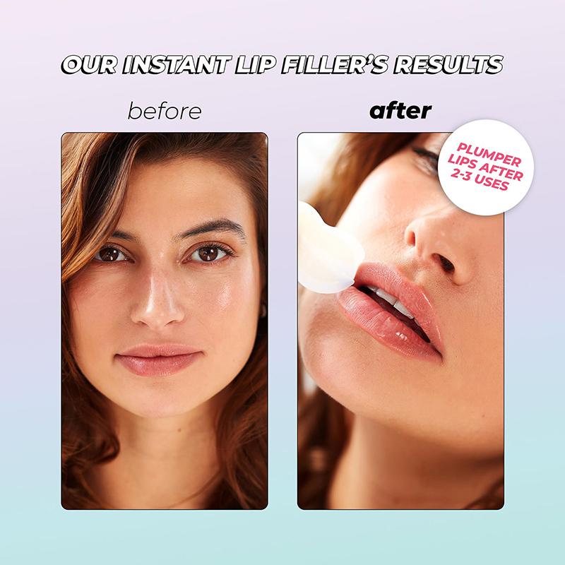 1 Pair Hyaluronic Acid Microneedle Lip Patches For Anti Wrinkle Smoothing Mouth Smile Lift Firm Lips Plump Lips Skin Care Patch
