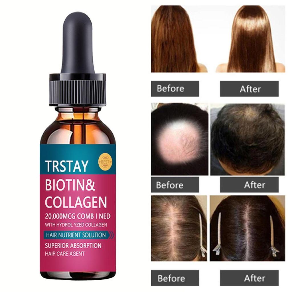5 ML/15 ML/30 ML/50 ML/nye ingefær hårvekstprodukter Hurtigvoksende hår essensiell olje forhindrer hårtap Olje hodebunnsbehandling for menn kvinner
