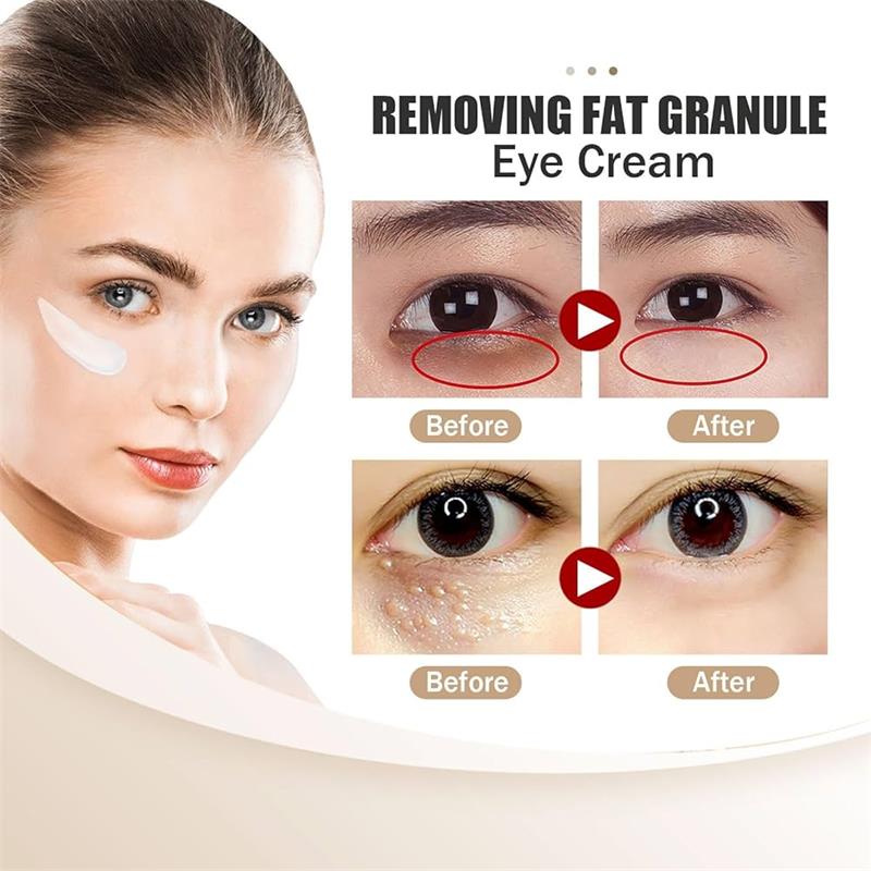 Crema Occhi Curcuma Retinolo Anti Occhiaie Rassodante Pelle Sbiadisce Linee Sottili Siero Stick Riparazione Istantanea Occhi per la Cura degli Occhi delle Donne