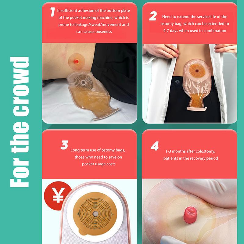 10 Pcs Ostomy Barrier Strips Spunlaced Non-Woven Elastic Barrier Strips For Colostomy Bag Stoma Care Supply For Fixed Chassis