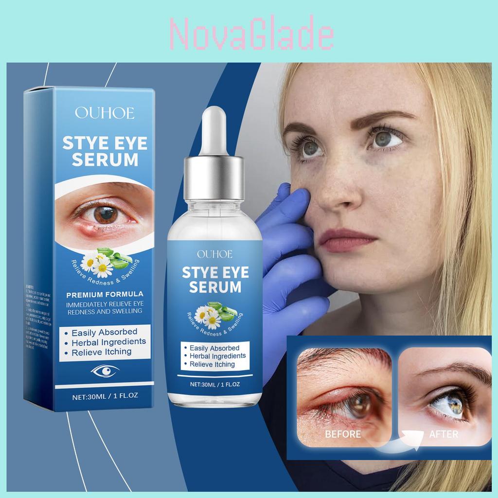 Ouhoe Gentle Moisturizing Eye Care Liquid For Soothing Relief And Daily Hydration 30ml