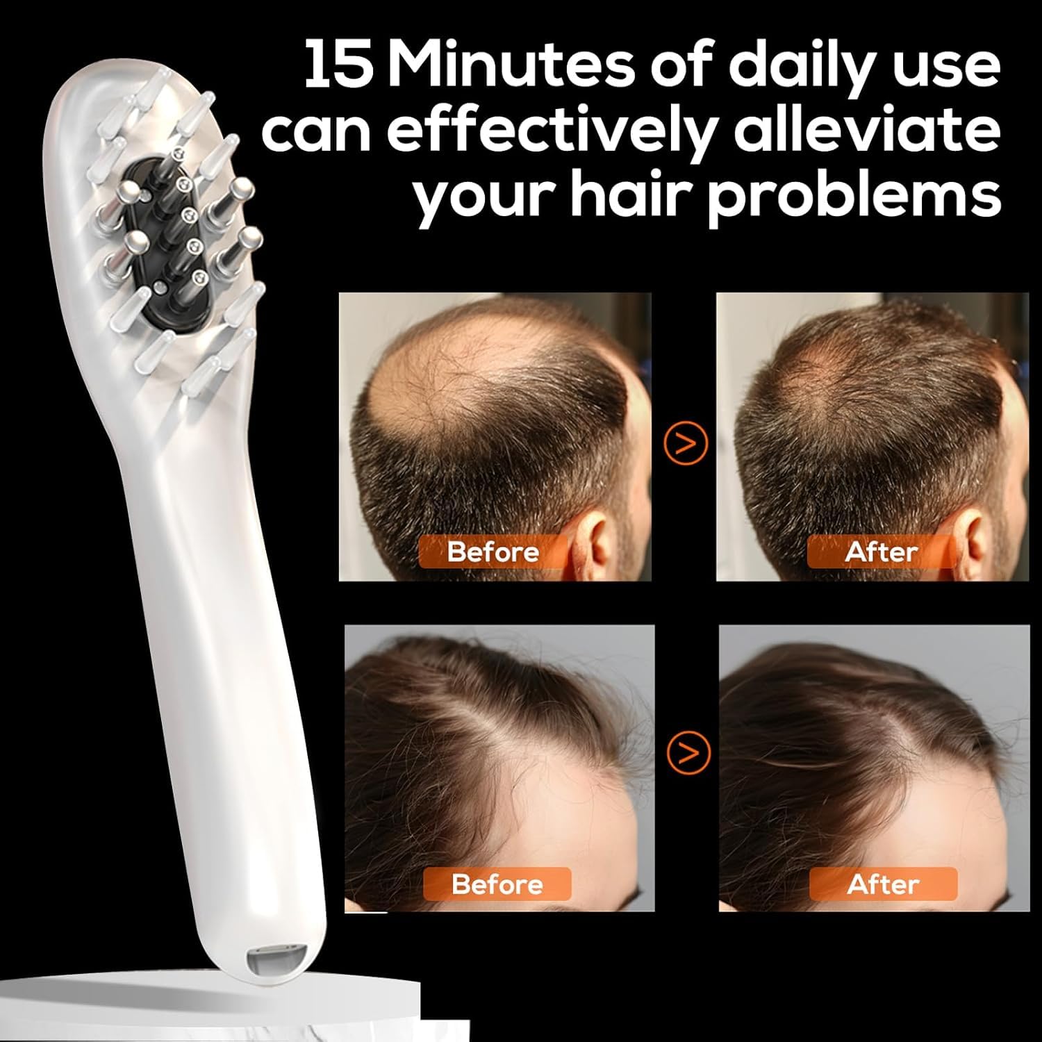 Лазерная расческа для роста волос, Модель: Лазерная расческа-001, Стимулирует рост волос у женщин и мужчин, Лазерная расческа - это ручная расческа в форме низкоуровневого лазера