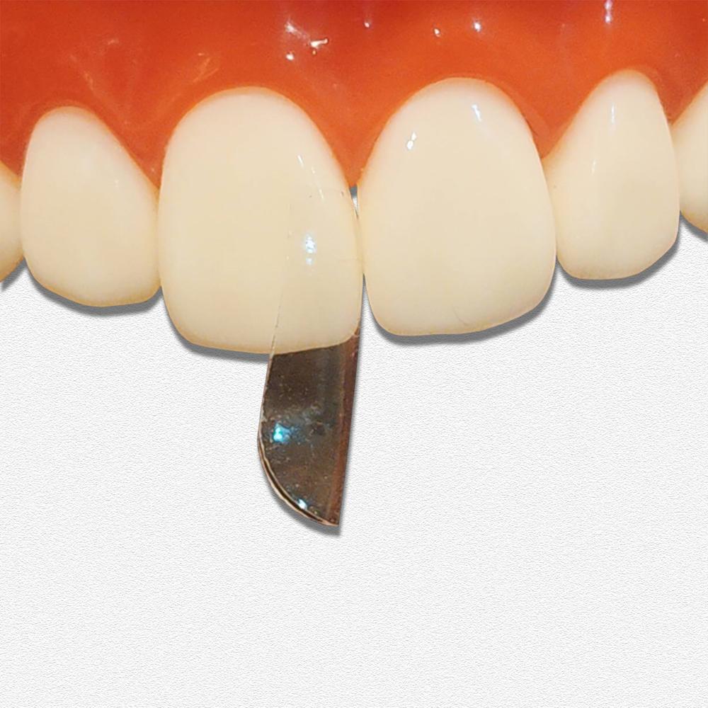 Dental Matrix Bands Anterior Matrix Strip Metal Matrices Sectional Contoured Matrix System Transparent Bow Anterior Matrices
