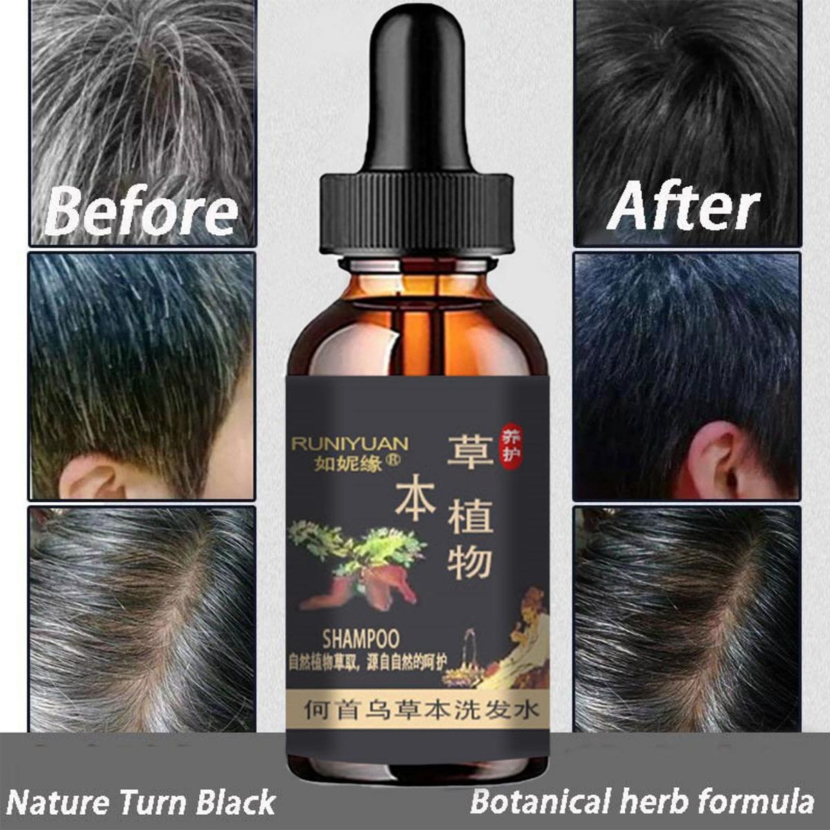 

Кондиционер для волос Способствует росту более длинных и густых волос Увлажняющий уход за волосами Эфирное масло Укрепление волос Жизненная сила эссенция 5ml