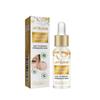Tratamiento Eliminador de Milia Sérum Eliminador de Manchas de Milia Para el Rostro Ayuda a Reducir las Milia