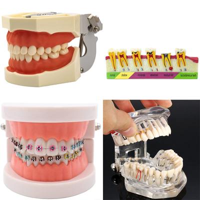 Standard Dental Typodont Model with Removable Teeth for Teaching and Demonstration