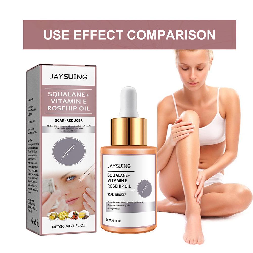 Scar Surgery Scar Dilution Cream To Burn The Impression Scar Dilution Surgery Beard Cream Remov I3U7