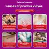 Vulvar itching Gynecological special anti-itching and sterilization ointment for private parts Pimple fungal vulvitis Vulvar itching