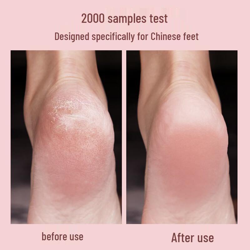 

MKS Electric Rechargeable Foot Callus Remover NV8615B