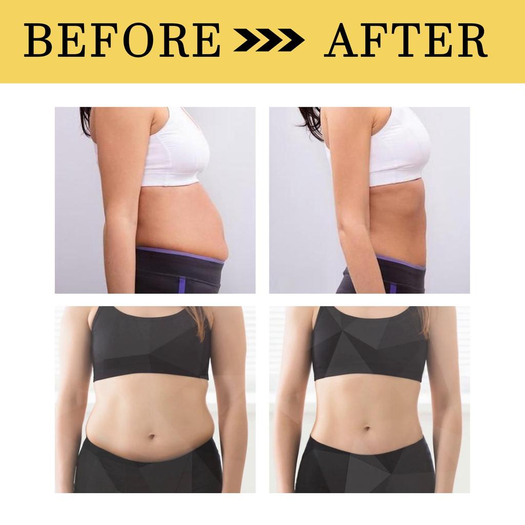10 Piece Set Of Body Shaping Patches, Navel Patches, Honey Acupoint Patches, Shaping Patches, And Fitness Patches
