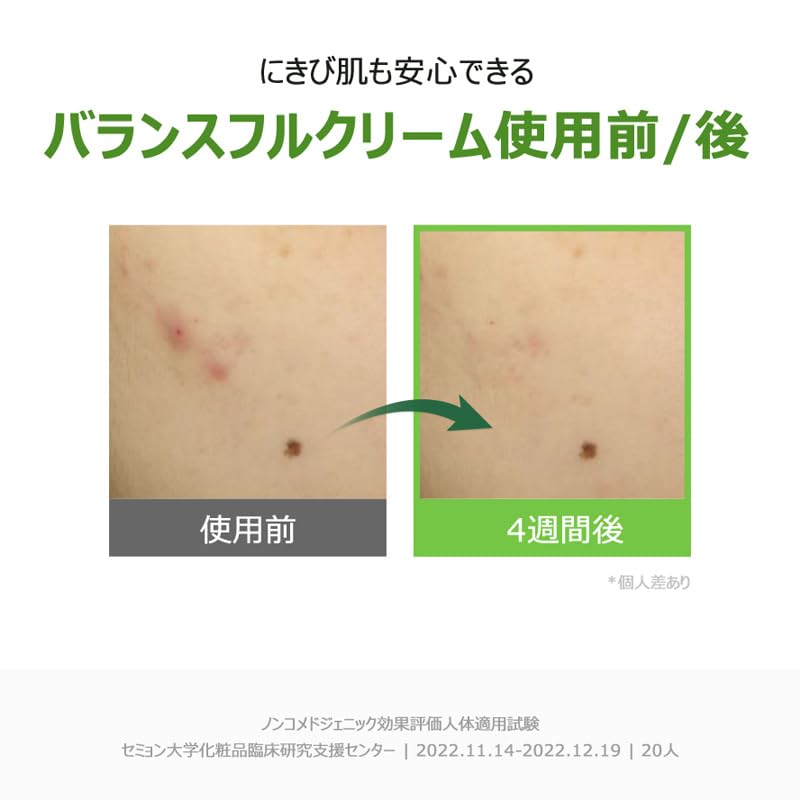 Torriden Balanceful Cica Cream 80ml Face Cream CICA Cica Moisturizing Moisture to the stratum corneum Gel cream Sensitive skin Inner dry Sebum Oily