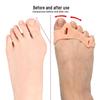 Silicone Forefoot Arch Support & Thumb Corrector Pad