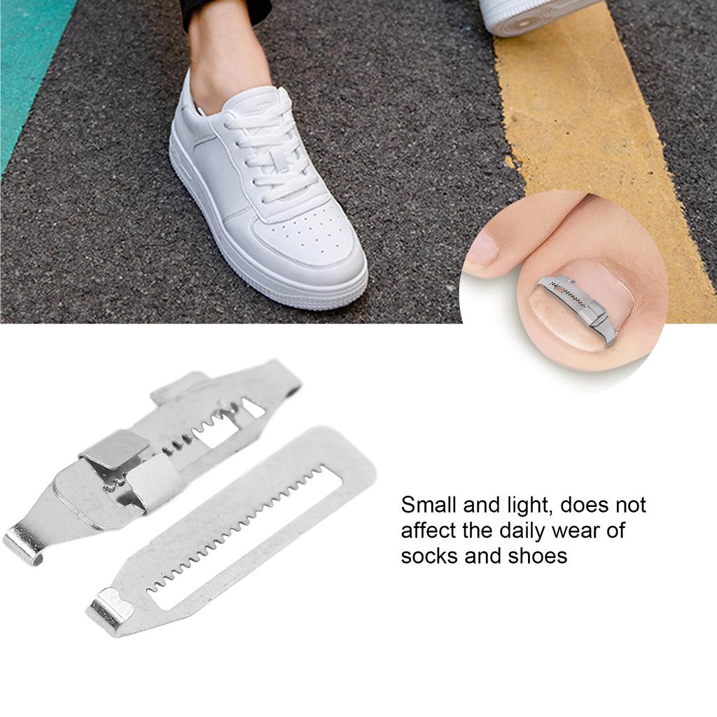 Ingrown Toenail Corrector Stainless Steel Paronychia Correction Tool with Adhesive Tape for Toenail Correction