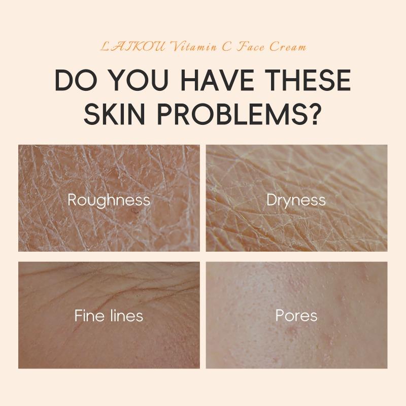 LAIKOU Vitamin C Whitening Cream Remove Freckle Blemish Brighten Moisturizing Face Cream 25g