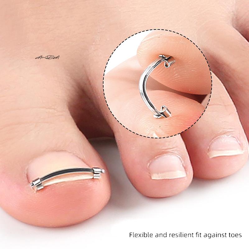Ingrown Toenail Pedicure Tool - Curved Clamp Toe Nail Care Straightening Correction Clip for Toes - Embed Nail Care Tool