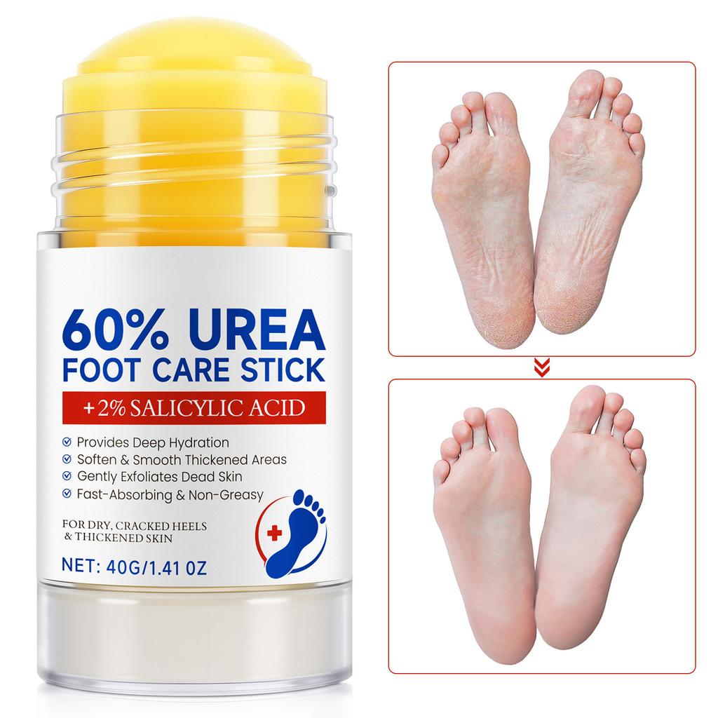 Urea Foot Care Cream, Moisturizing And Exfoliating Foot Care Stick, -drying And Cracking, Non-greasy 40g