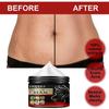 Fade Repair Scar Repair Cream Is Suitable for Care of Stretch Marks and Pregnant Skin