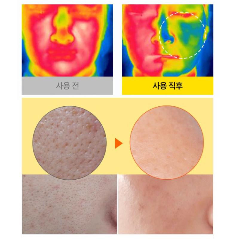 PIBUMI Pore Clean Zero LHA Ampoule 50ml