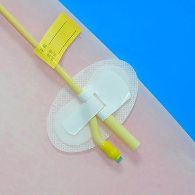 Haftender Harnkatheterhalter Beinband G-Anker Stabilisierungsvorrichtung zur Befestigung von Nephrostomiekathetern - Beutelhalter Harn-Beinband